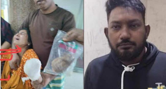 সিদ্ধিরগঞ্জে ভাসুরের দায়ের কোপে গৃহবধূর হাতের কব্জি বিচ্ছিন্ন