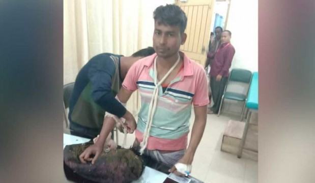 মাছ ধরার সময় বিএসএফের গুলিতে আহত বাংলাদেশী যুবক