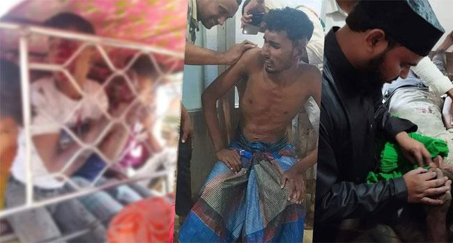 বাঁশখালীতে সিএনজি অটোরিকশা গ্যারেজে গ্যাস সিলিন্ডার বিস্ফোরণ