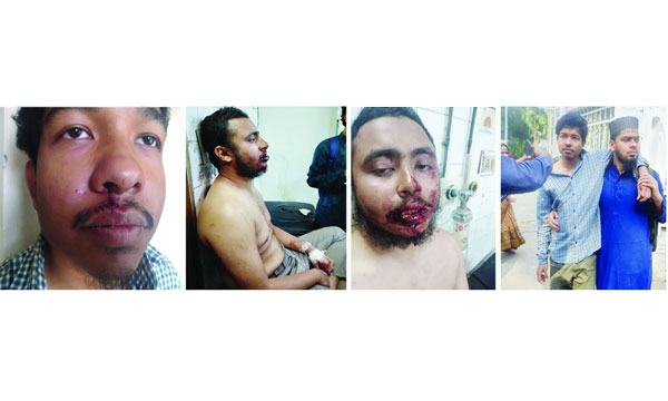 ঢাবিতে রমজানের সেমিনারে ছাত্রলীগের হামলা, আহত ৬
