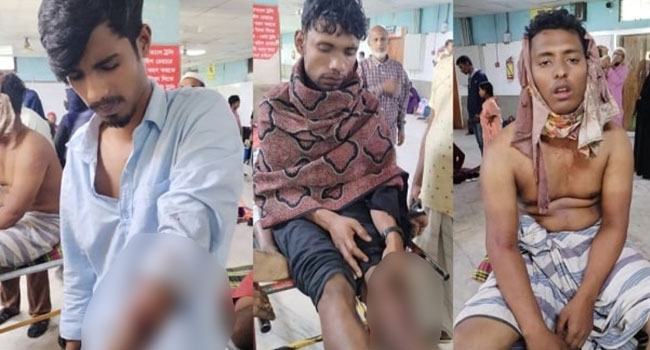 রূপগঞ্জে আধিপত্য বিস্তারের জেরে দু’পক্ষের সংঘর্ষ, গুলিবিদ্ধ ৮