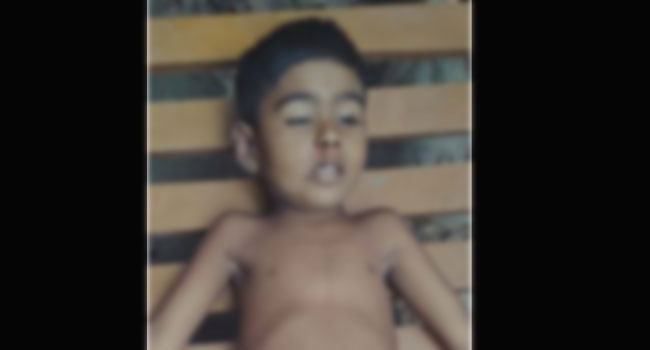 চৌগাছায় কাঠচাপা পড়ে শিশু নিহত
