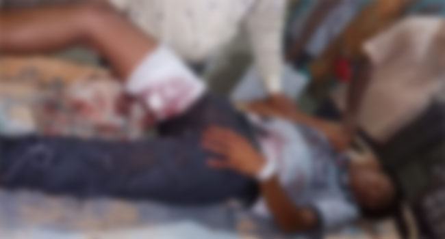 গোবিন্দগঞ্জে কিশোর গ্যাংয়ের হামলায় ৮ জন আহত