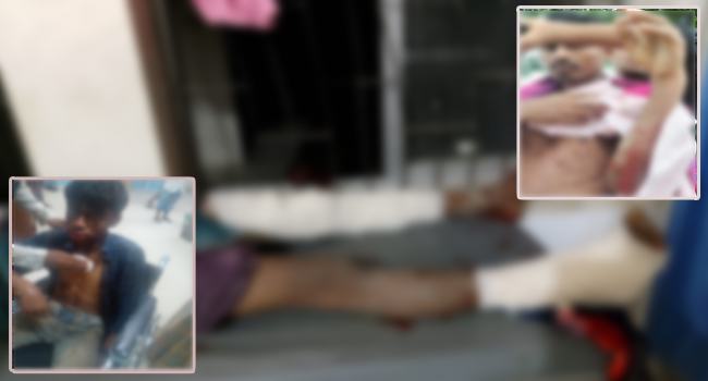 মিয়ানমার সীমান্তে মাইন বিস্ফোরণে ৩ বাংলাদেশী আহত
