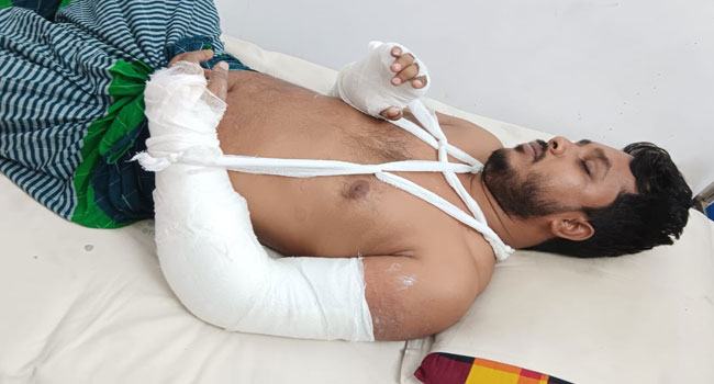 শিক্ষকের ২ হাত ভেঙ্গে দিল কিশোর গ্যাং
