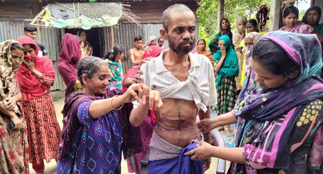 ঈশ্বরগঞ্জের নিখোঁজ সেলিমকে মিল্টন সমাদ্দারের প্রতিষ্ঠান থেকে উদ্ধার, কিডনি নেয়ার অভিযোগ
