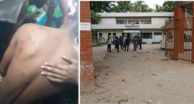 শৈলকুপায় আ’লীগ কর্মী আটকের ঘটনায় থানা ঘেরাও : পুলিশের গুলি, আহত ৩০