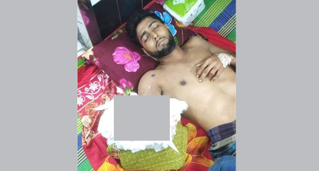 শৈলকুপা থানায় হামলার ঘটনায় মামলা, কেটে ফেলতে হলো গুলিবিদ্ধ ফিরোজের হাত