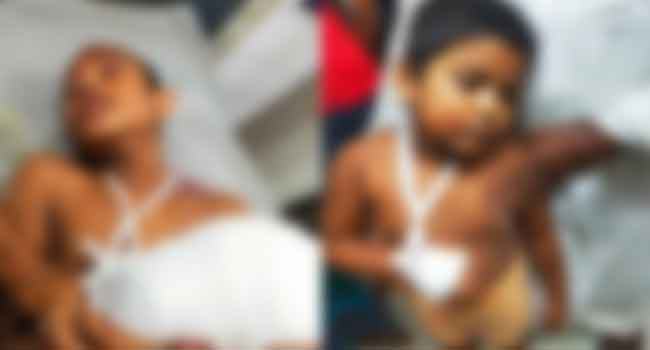 বল ভেবে ককটেলে আঘাত, বিস্ফোরণে আহত ২ শিশু