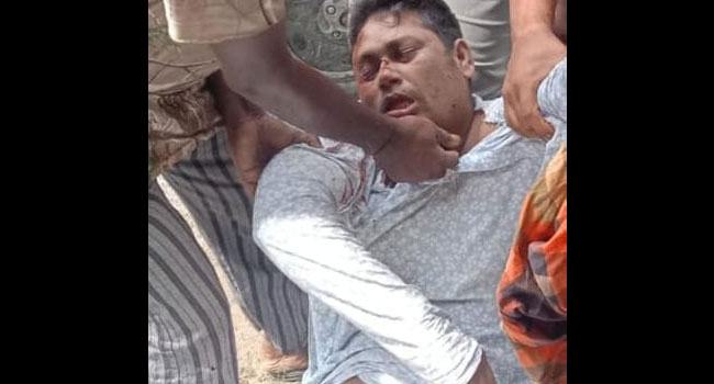 শ্রীনগরে সালিশে হামলা, আহত ব্যক্তির মৃত্যু