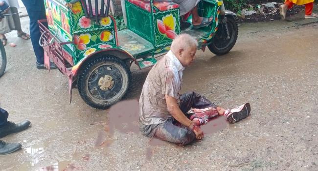 নাটোরে সমাবেশে হামলা : বিএনপি নেতা ও রাসিক সাবেক মেয়র বুলবুল আহত