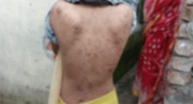 সাভারে শিশু গৃহপরিচালিকাকে নির্যাতনের অভিযোগ, আটক ২