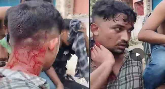 কোটা আন্দোলনে বরিশাল বিশ্ববিদ্যালয়ের শিক্ষার্থী গুলিবিদ্ধ