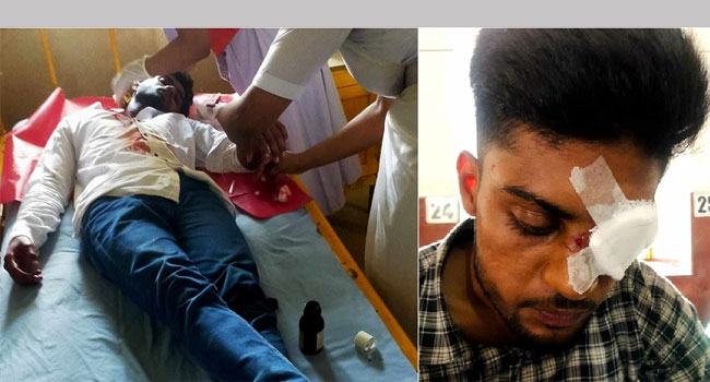 মির্জাপুরে ছাত্রলীগের হামলায় ছাত্র আন্দোলনের ৩ সমন্বয়ক আহত