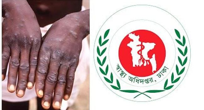 মাঙ্কিপক্সের লক্ষ্মণ দেখা গেলে ‘১৬২৬৩ ও ১০৬৫৫’তে যোগাযোগের অনুরোধ
