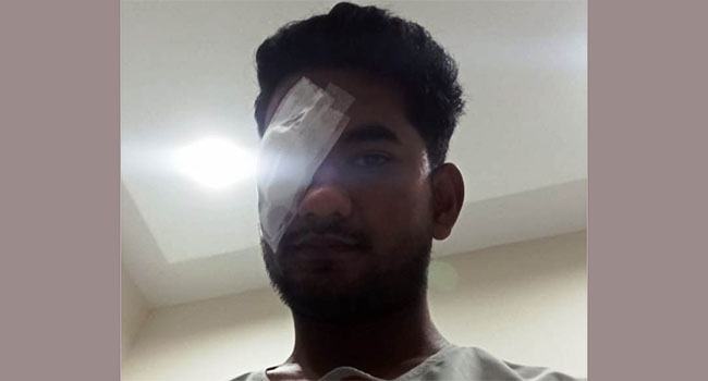 ছাত্র আন্দোলনে পুলিশের গুলিতে অন্ধত্বের পথে ক্রিকেটার সাকিব