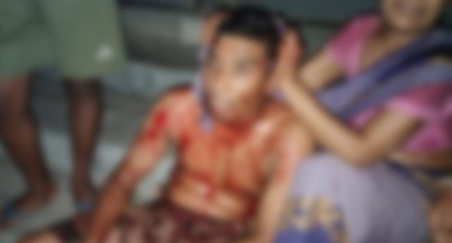 সিংড়ায় ২ জনকে কুপিয়ে জখম