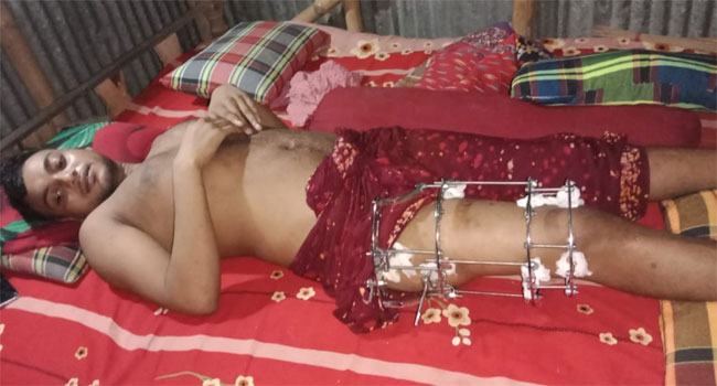 চুয়াডাঙ্গায় পুলিশের গুলিতে পঙ্গু মোফাইল : প্রয়োজন অর্থ সহায়তা