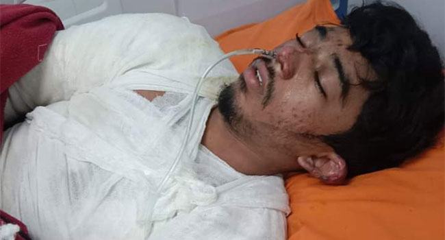 আমতলীতে ২৭ দিন পর মারা গেলেন আগুনে দগ্ধ স্কুলছাত্র