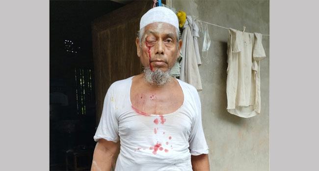 মিরসরাইয়ে জামায়াতের সাবেক আমিরের ওপর হামলা