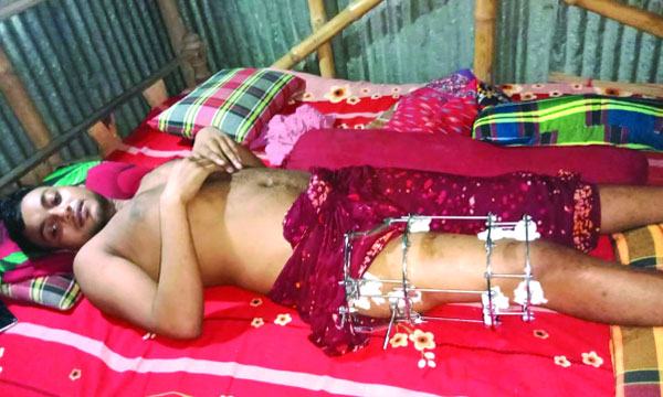পঙ্গু হতে চলেছেন মোফায়েল চিকিৎসায় সহায়তা প্রয়োজন