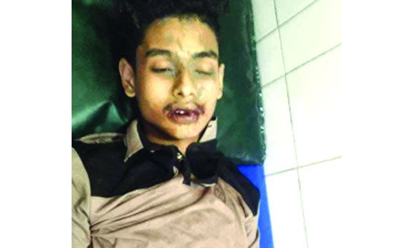 ছোট ভাইকে বাঁচাতে গিয়ে প্রাণ গেল বড় ভাইয়ের