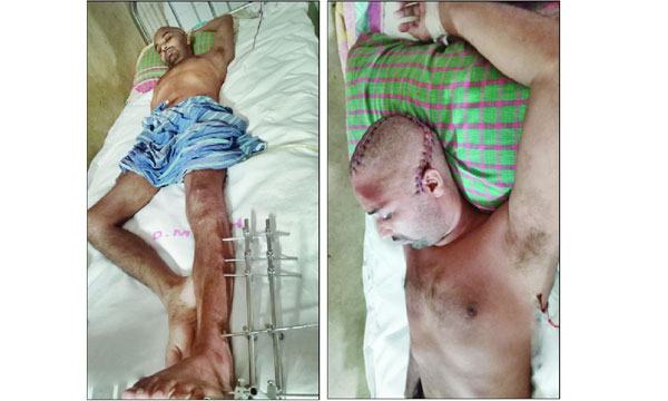 মাথায় পুলিশের আঘাতে বাকরুদ্ধ শরীফুল, ভেঙেছে হাঁটুও