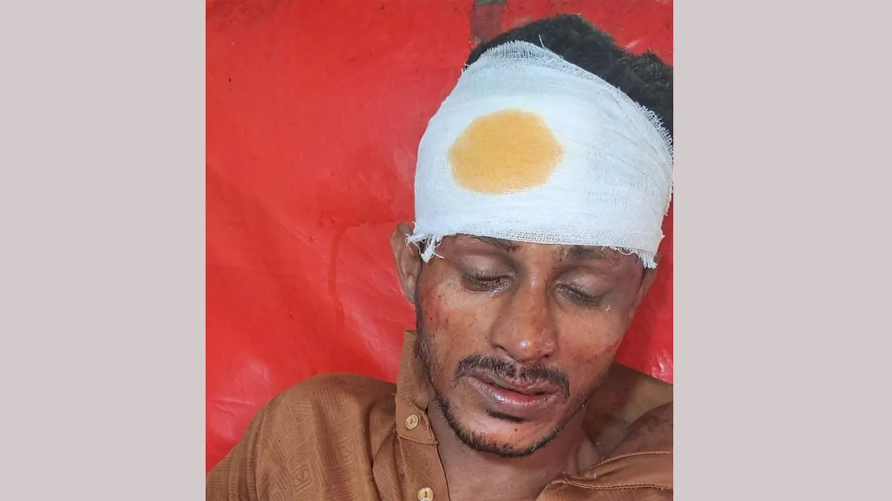 সোনাগাজীতে প্রতিপক্ষের হামলায় যুবদল কর্মী গুরুতর জখম