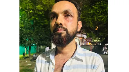 কৃষি ক্যাডারের জুনিয়র কর্মকর্তার ঘুষিতে রক্তাক্ত সিনিয়র