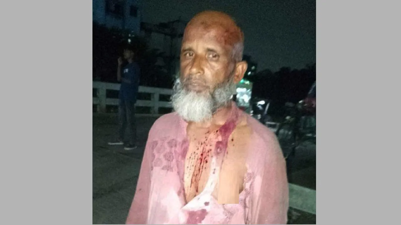 নারায়ণগঞ্জে জামায়াত নেতাকে কুপিয়েছে যুবলীগ ক্যাডার