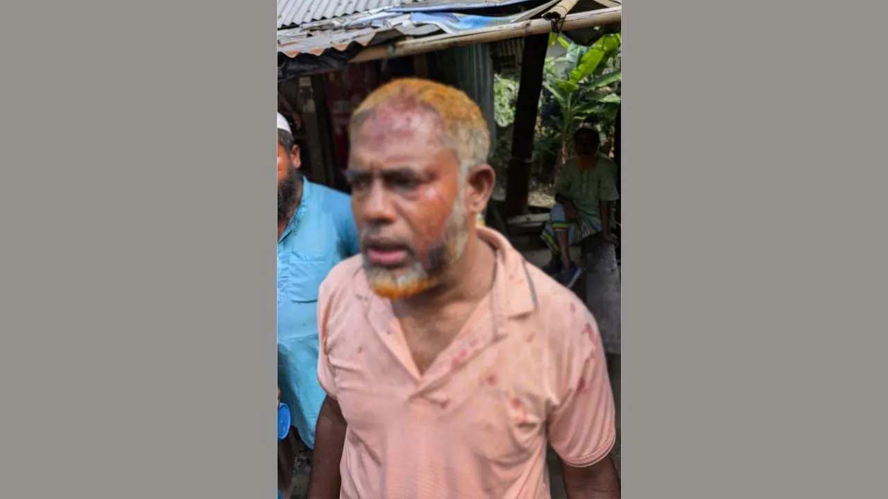 গৌরনদীতে উচ্ছেদ অভিযানের জেরে বিএনপি নেতাকে কুপিয়ে জখম