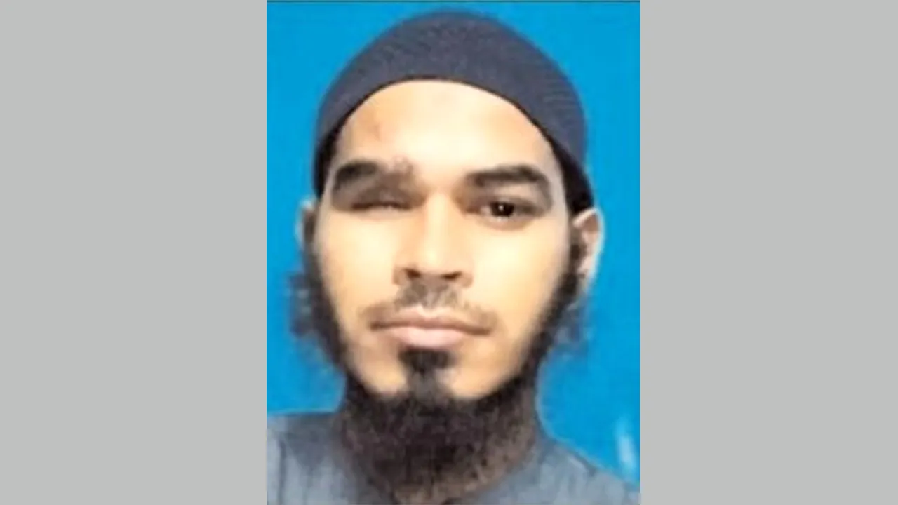 জুলাই আন্দোলনে আহত বাবু হারিয়েছেন চোখের আলো