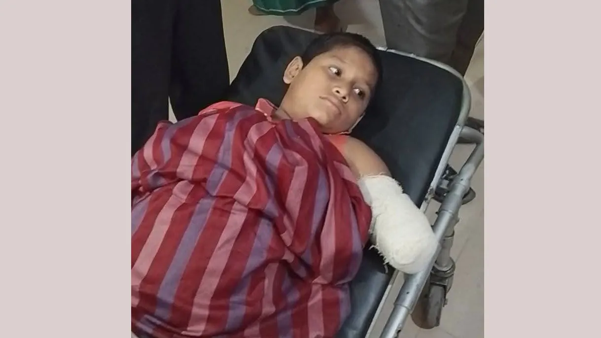 সড়ক দুর্ঘটনায় বিচ্ছিন্ন শিশু রেহানের বাম হাত আর জোড়া লাগলো না!