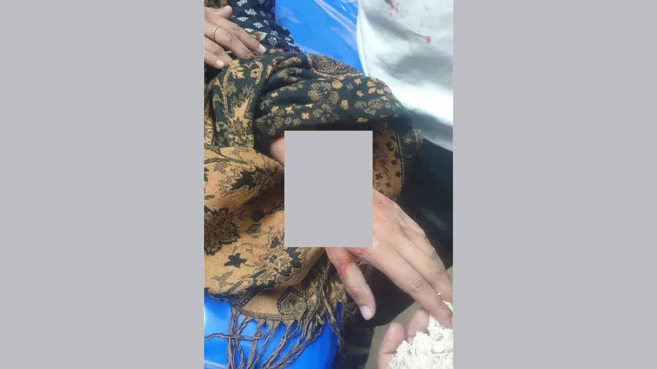 বন্দরে সাংবাদিক-কন্যাকে কুপিয়ে হত্যার চেষ্টা, শাশুড়ি গ্রেফতার