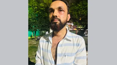 ঘুষিতে আহত সেই কৃষি কর্মকর্তাকেই তাৎক্ষণিক বদলি