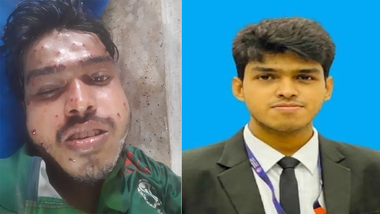 ৫৬টি স্প্লিন্টারে রায়হানের শরীর ঝাঁজরা করে দেয়