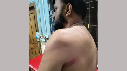 নিষিদ্ধ আওয়ামী লীগের হামলায় বিএনপি-জামায়াতের ৪ নেতা আহত