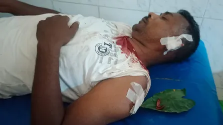 কাপড় ব্যবসায়ীর কান কামড়ে ছিঁড়ে নিলো আরেক ব্যবসায়ী