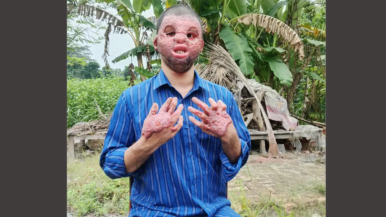 ভাঙ্গায় মানবিক সাহায্যের আবেদন