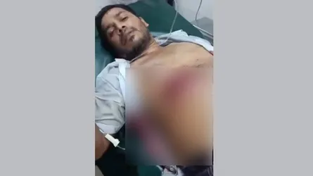 চকরিয়ায় দিনদুপুরে ব্যবসায়ী গুলিবিদ্ধ