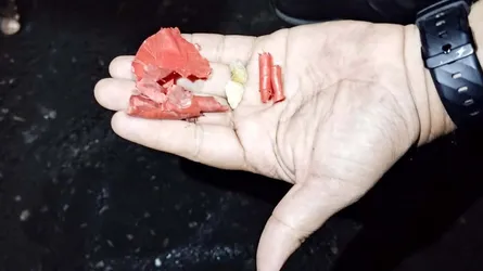 পল্টন মোড়ে দুই ককটেল বিস্ফোরণ