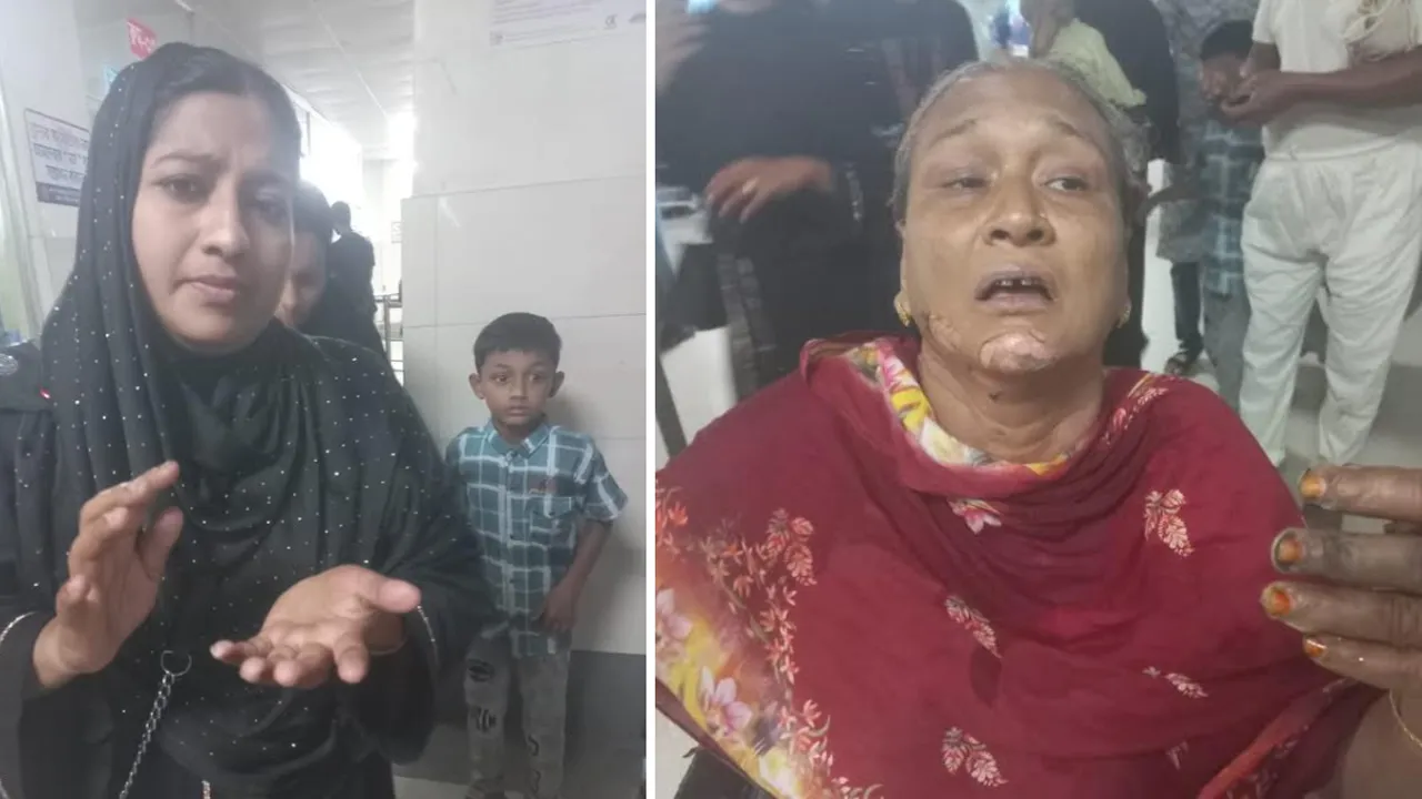 চট্টগ্রামে চলন্ত অটোরিকশায় পেট্রোল বোমা নিক্ষেপ : ২ নারী দগ্ধ