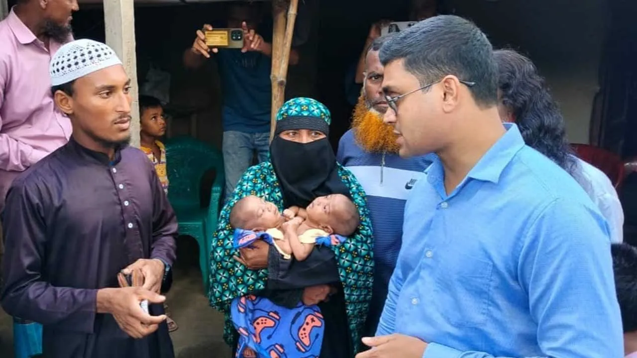 দৌলতপুরের জোড়া লাগানো যমজ শিশুর চিকিৎসার দায়িত্ব নিল স্বাস্থ্য মন্ত্রণালয়