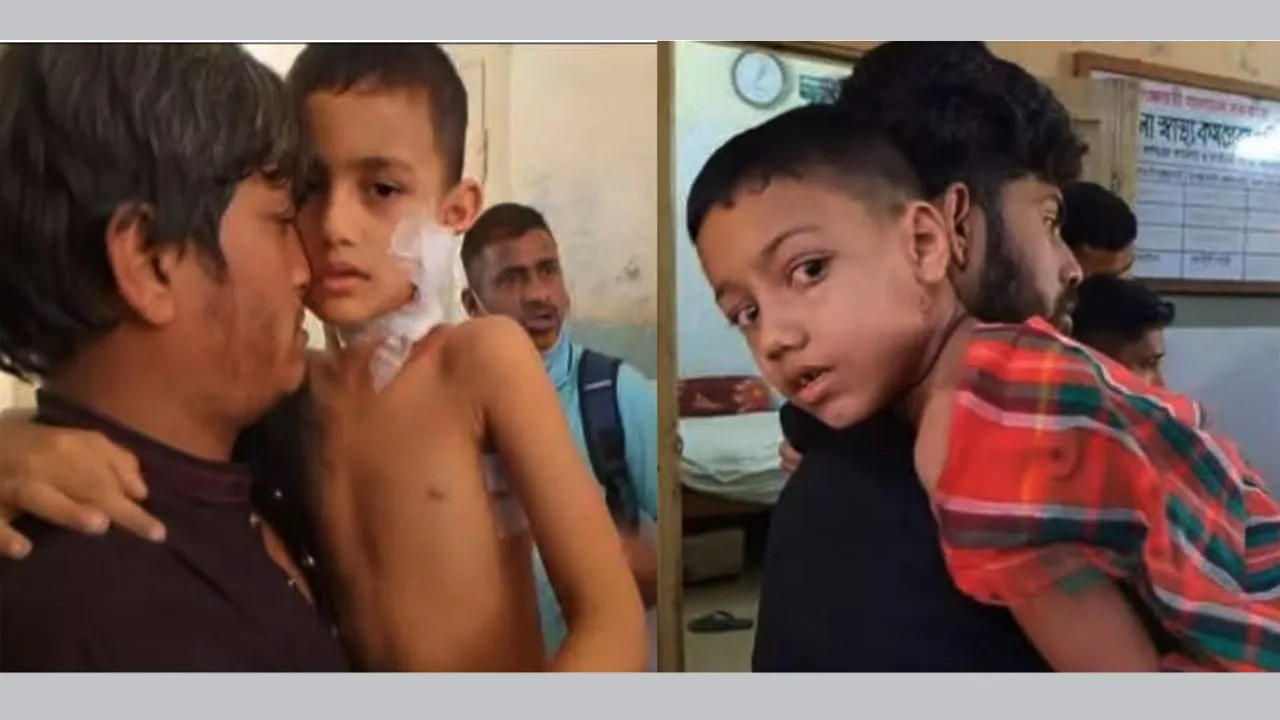 দে‌বিদ্বা‌রে পাগলা কুকুরের কাম‌ড়ে ৫ শিশু আহত