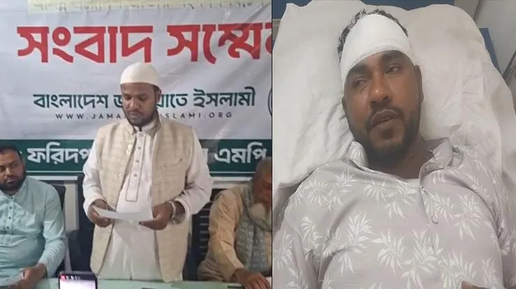 ফরিদপুরে জামায়াত নেতাকে কুপিয়ে জখম