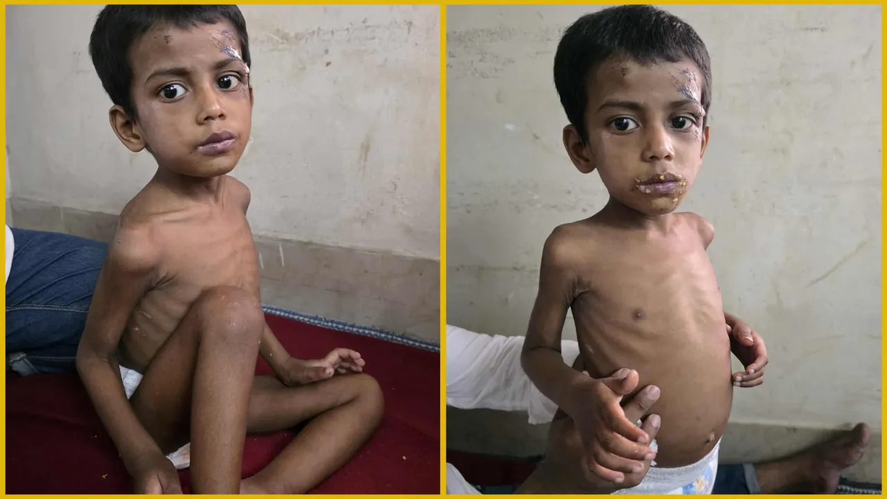 খাবার চাইলেই বাবার অমানবিক নির্যাতন, তালাবদ্ধ ঘর থেকে শিশু উদ্ধার