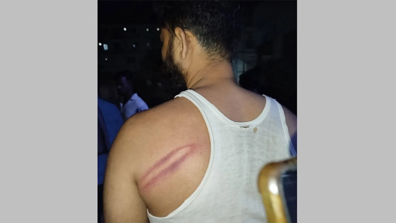 দুর্বৃত্তদের হামলায় গাজীপুরে জামায়াতের ১০ নেতাকর্মী আহত