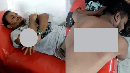 শ্রীপুরে শিক্ষক ও সাবেক ছাত্রদল নেতাসহ ৩ জনকে পিটিয়ে আহত