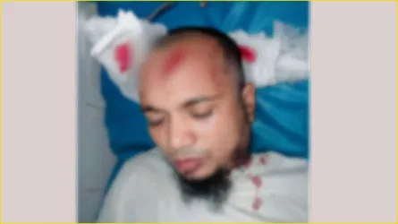 মাদারীপুরে সন্ত্রাসী হামলায় জামায়াত নেতা গুরুতর আহত