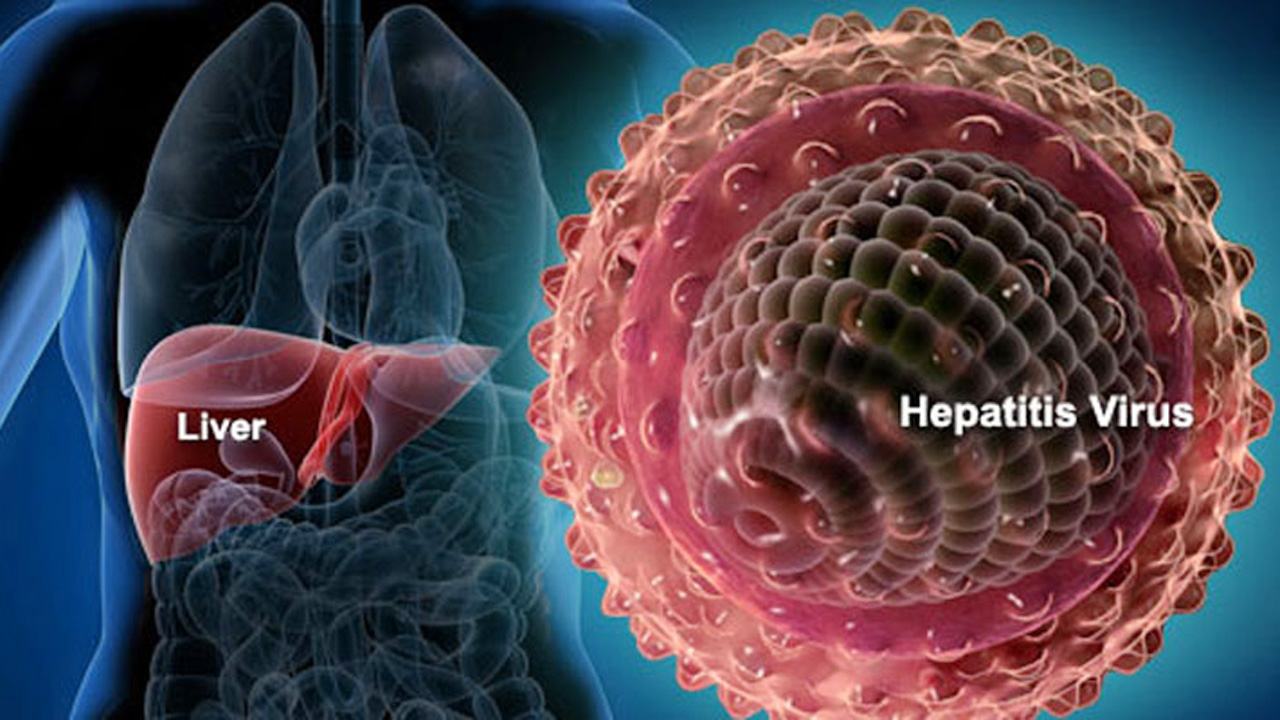 Hepatities